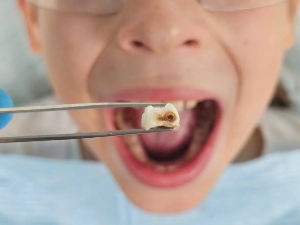 Best Broken or Cracked Tooth Emergency Dentist in Oakleaf Plantation, FL